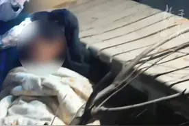 视频惊心！玩耍中，儿童头部被60厘米钢条插入！图片