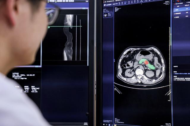 阿里巴巴发布AI向善行动报告 AI向善是技术走向成熟的试炼场