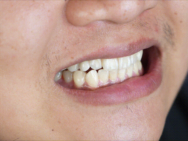 咖啡是白天喝的，牙是夜里变黄的