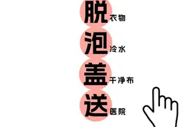 吃火锅烫嘴后竟全身溃烂！遭遇烫伤请记住这些护理技巧图片