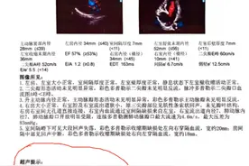 女孩身患四种先心病，却互相“修复”  ，心内科医生感叹：生命有时候，很神奇图片