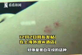 网友2500元住上海顶级酒店被蛇咬？后续来了！图片