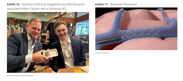 脑机接口——人与AI“共生”