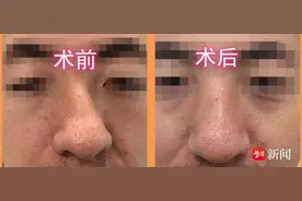 10年的面容缺憾，花了3小时终于补上了！图片