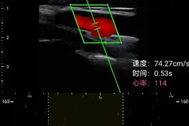 全球首份！华大在珠穆朗玛峰峰顶传回超声图和脑电数据图片