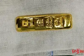 11岁男孩误吞100克金条2天后取出 治疗医生：金条细长图片