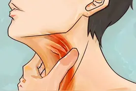 咽部异物感总好不了？该怎么办？图片