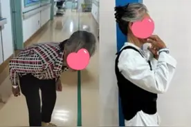 七旬阿婆脊柱弯成90度！专家：老年驼背是病不是老图片
