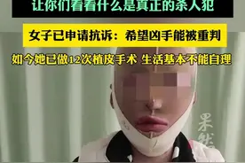 女孩被前男友泼汽油烧伤致残毁容，凶手一审获刑12年，受害人申请抗诉图片
