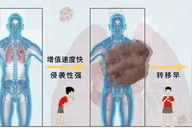 视频｜有问医答：这种肺癌“小”，却很凶险图片
