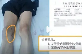 17岁体育生错切右膝，主刀医生被撤职不应是句点图片