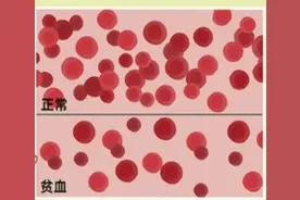 脸色蜡黄、心慌气短，全球1/5的人如此！你可能是缺了它……图片