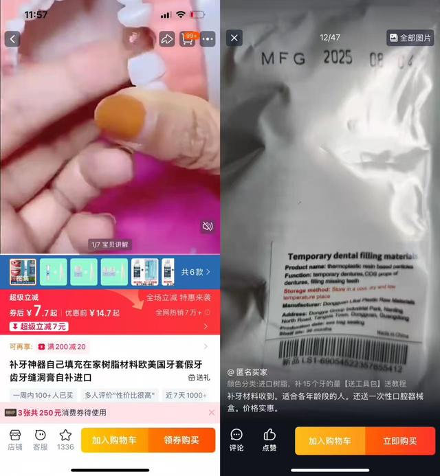 宣称“安全无毒”“永久修复”，网售树脂补牙产品风险有多大？