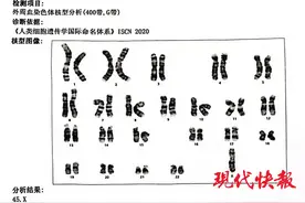 10岁女孩身材矮小竟是得了罕见病，医生：只有女孩才会得，发病率1/4000图片
