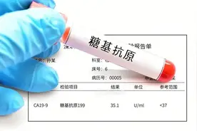 【朝医科普】带您读懂肿瘤标记物——CA199图片