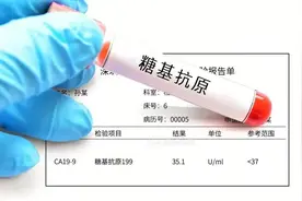 【朝医科普】带您读懂肿瘤标记物——CA199图片