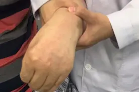 【偏瘫治疗在望京】颈七神经移位移植术治疗偏瘫图片