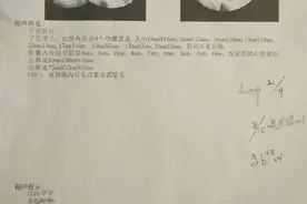专家称9胞胎产妇或面临大月份流产，三胎或三胎以上妊娠医生建议减胎图片