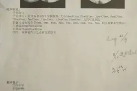 罕见！江西一女子怀上九胞胎图片