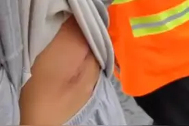 芜湖一男童疑被家长打致背部现伤痕，路人怒斥，警方：案件正办理，会妥善安置图片