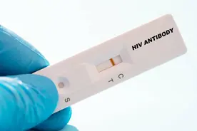 公共场所接触用过的HIV试剂盒！疾控专家：体外病毒活性弱，感染风险很小图片