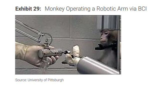 脑机接口——人与AI“共生”