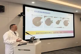 全球首创！不开刀 穿刺就能精准“揪出”肺小结节图片