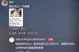 16岁森碟下巴后缩 医生称或影响口腔功能图片
