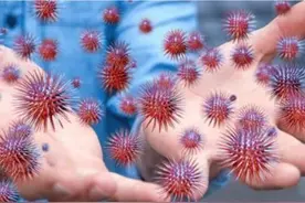 生殖器疱疹怎么治疗？听专家带你正确认知性传播疾病③图片