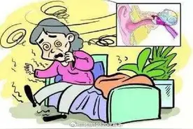 搅动天地的小石头——耳石症图片