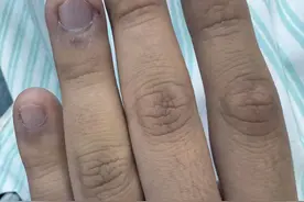 一盘家常菜竟让年轻小伙瘫倒在地！这可不是开玩笑图片