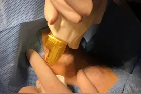 不手术也能治腋臭（狐臭）了图片