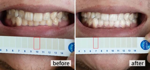 咖啡是白天喝的，牙是夜里变黄的