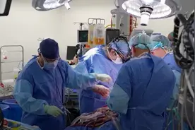 没有心脏也能活？澳洲男子靠“机器心脏”存活超100天，打破世界纪录！图片