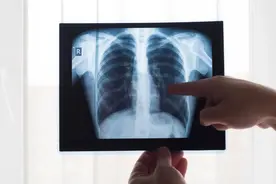 全国肿瘤防治宣传周 | 认识肺癌 科学抗癌图片