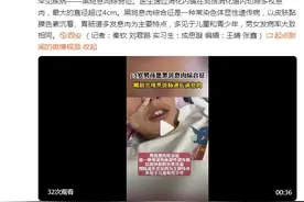 13岁男孩患罕见病：嘴唇发黑肠道长满息肉图片