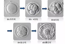 毓璜顶医院公益直播课第154期：揭秘试管婴儿中胚胎的选择和评分图片