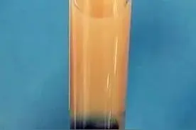 预防“牛奶”血，避免高油脂食品图片