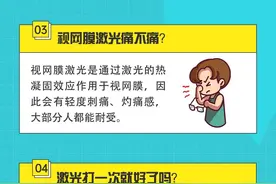 激光手术对眼睛有损伤吗？来看10问10答图片
