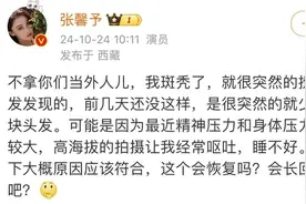 知名女演员自爆“斑秃”，压力是根源？头发还有望再长回来吗？图片
