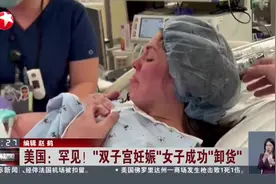 罕见！美国一女子“双子宫妊娠”成功“卸货”图片
