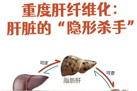 从“草帽姐”患病说起  一文读懂肝纤维化是个啥 |“医”点就透图片