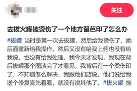 华西专家说，拔罐不是人人都适合，更不是人人都会拔！图片