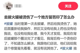 华西专家说，拔罐不是人人都适合，更不是人人都会拔！图片