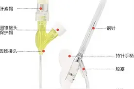 潍坊市中医院：孩子打了留置针，家长应该怎样护理？图片