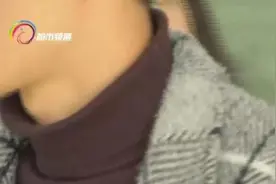 为什么有人一穿高领就浑身难受？小心是这种病……图片