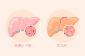 中老年人群：科学减重这样做→图片