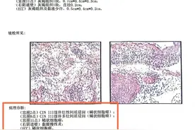 不痛不痒！女子竟查出癌症：难以接受！图片