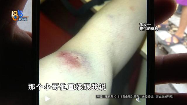 女子骑车被外卖小哥撞伤，本想私了要求赔三百医药费，外卖小哥：我只有三块钱