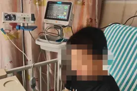 福建男童越长越丑，到医院一查，爸妈傻眼了……这病很多家长不知道图片
